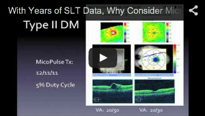 With Years of SLT Data, Why Consider MicroPulse? 