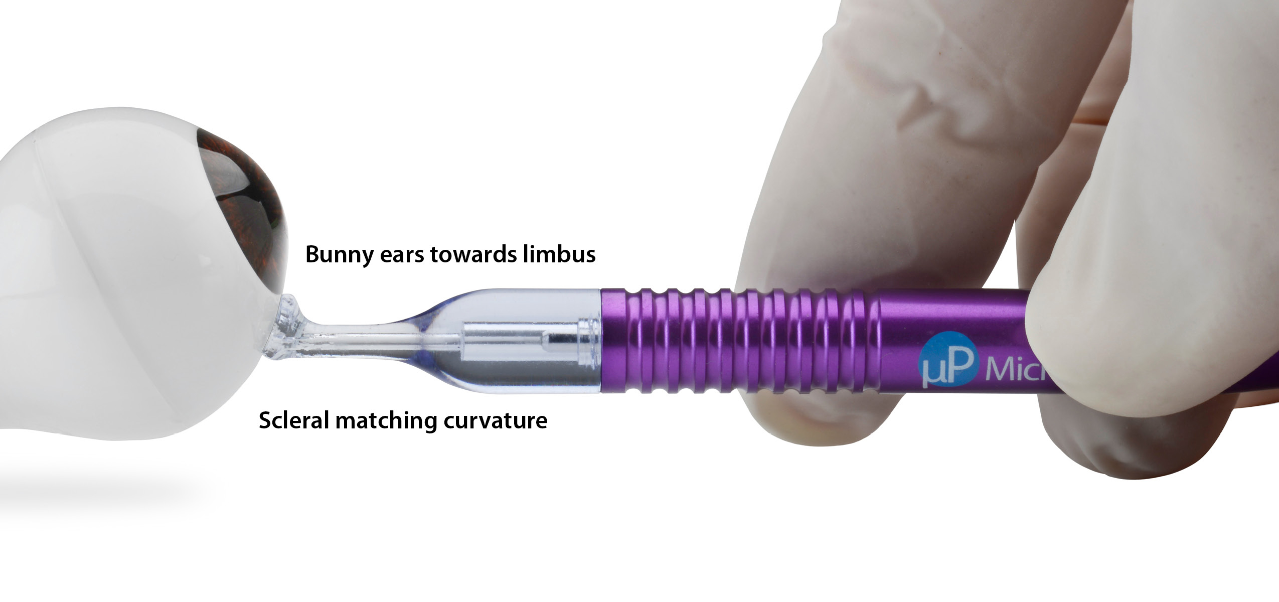 MicroPulse P3 Device for NonIncisional Therapy